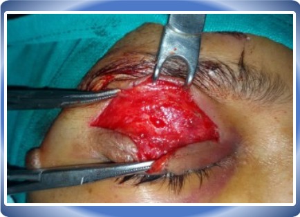 FACIAL INJURY